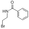 N-(2-BROMO-ETHYL)-BENZAMIDE CAS#: 27110-61-8