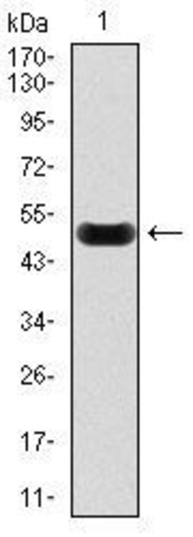 Anti-C-Reactive Protein (CRP) Antibody WB