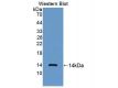 Anti-NT-ProBNP Antibody WB