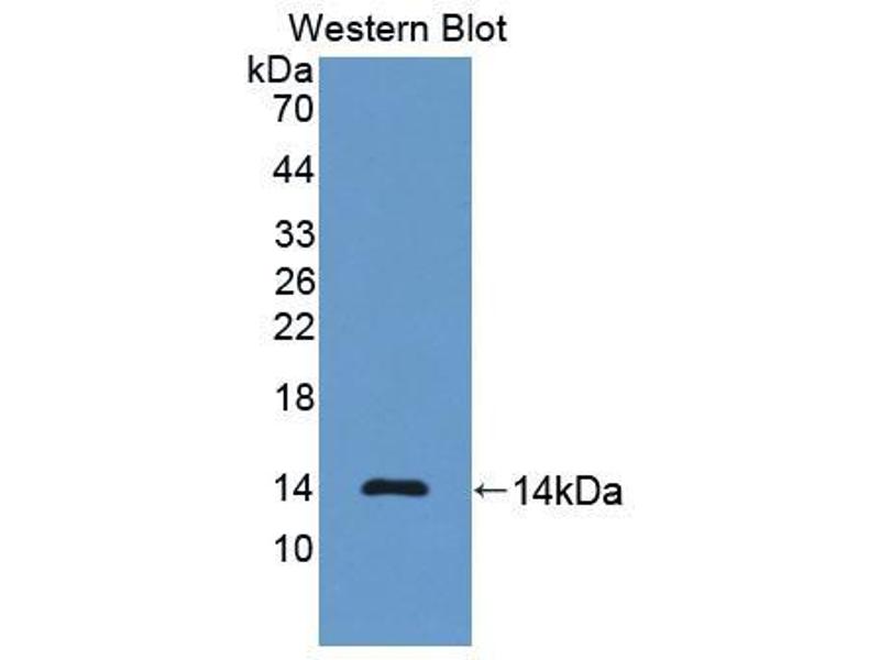 Anti-NT-ProBNP Antibody WB