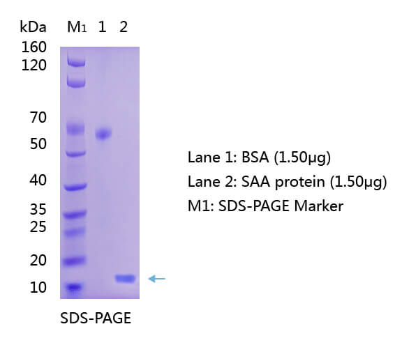 Anti-Serum Amyloid A (SAA) Antibody WB