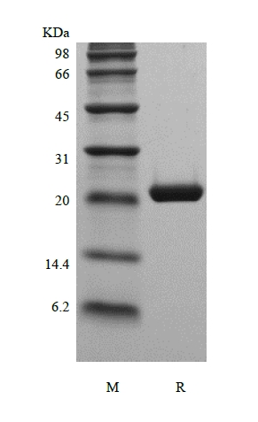 SDS-PAGE of Recombinant Murine Cardiotrophin1